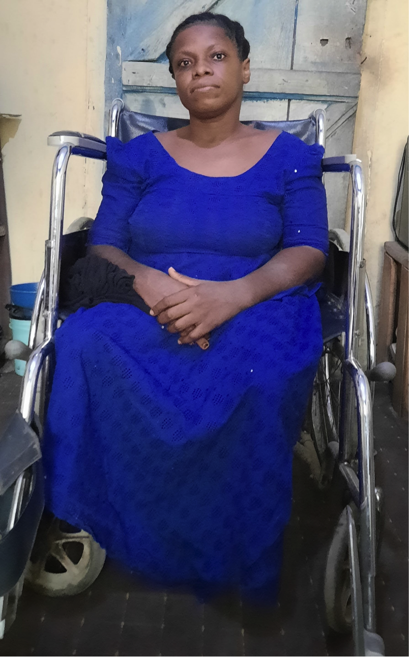 Osun Received N1.5bn in Pandemic Donations but Turned its Back on People with Disabilities